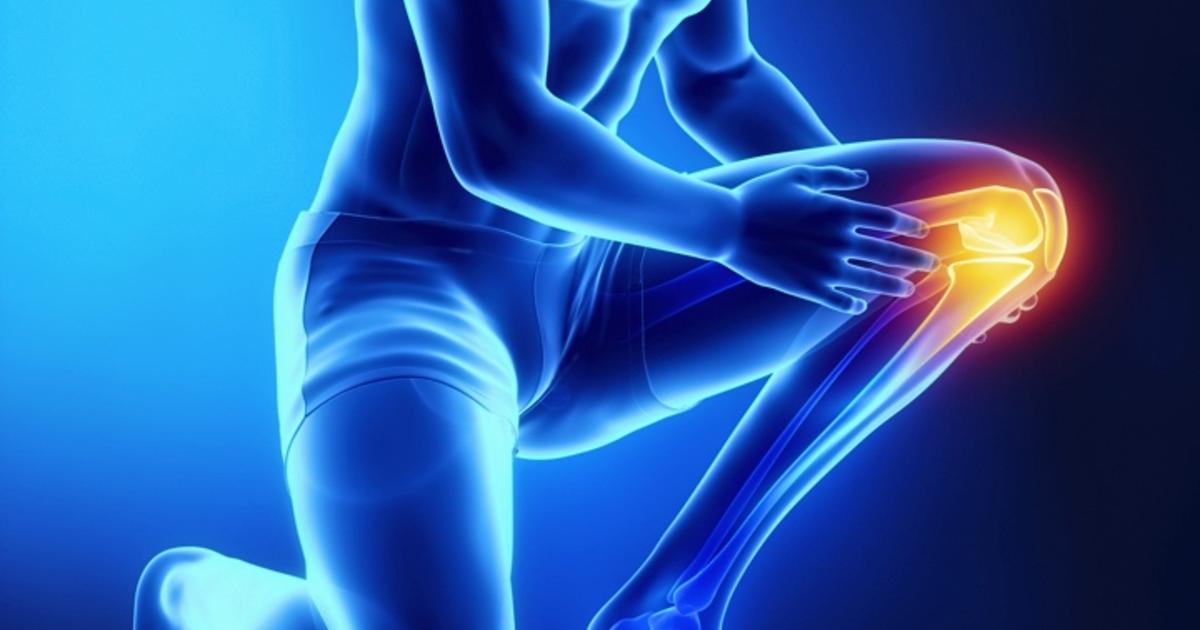 前十字靭帯(ACL)損傷 イメージ