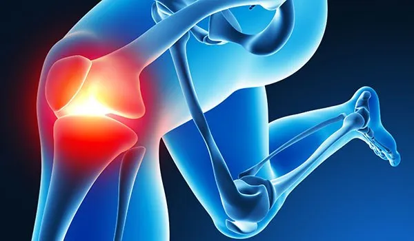 内側側副靭帯(MCL)損傷 イメージ